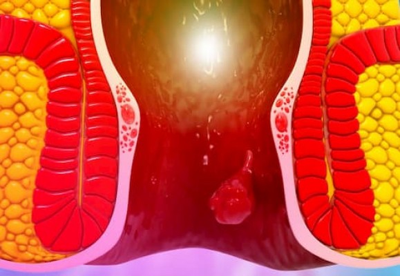 10 địa chỉ khám chữa bệnh lậu ở đâu tốt Hà Nội