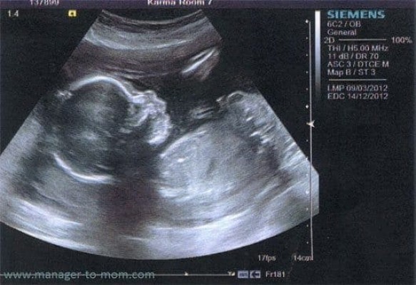 Bảng chỉ số thai nhi theo tuần tuổi đơn giản cho các mẹ