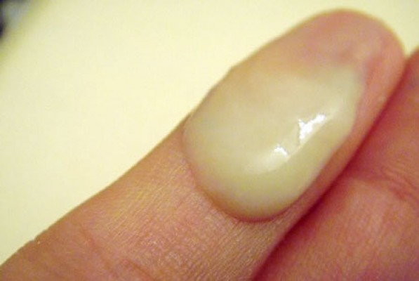 Ra chất nhầy màu trắng đục có phải mang thai hay bị bệnh gì