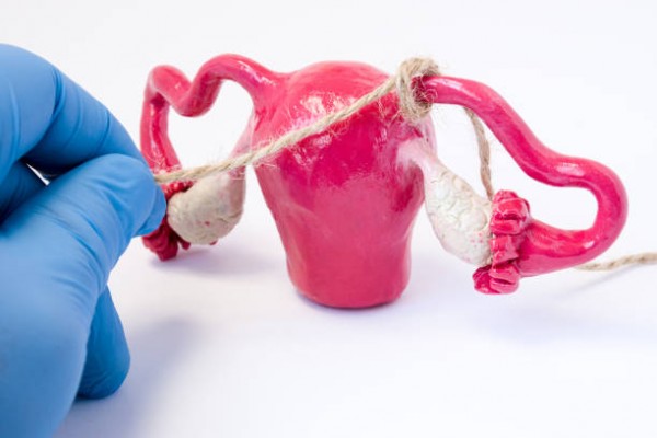 Thắt ống dẫn trứng là gì? Chi phí khoảng bao nhiêu tiền