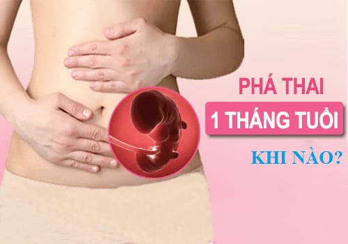 Phá thai 1 tháng tuổi an toàn